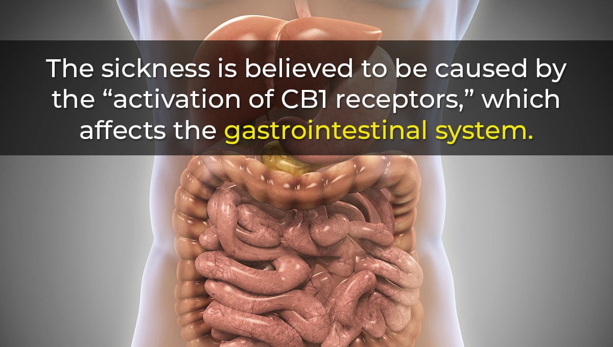 Cannabinoid Hyperemesis Syndrome (chs) Explained 